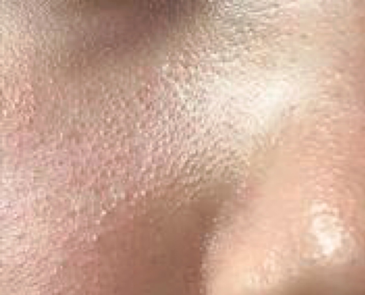 赤ちゃん 鼻の周り ポツポツ子育てお悩み相談コミュニティO