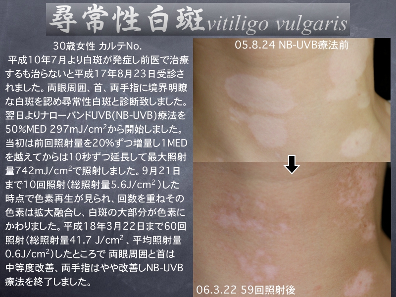 楽天市場 はたけ 皮膚 画像の通販