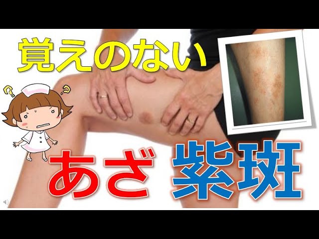 望月うかる🦖⭐️ on X: 