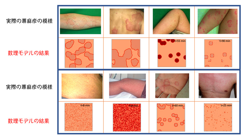 蕁麻疹について・水前寺皮フ科医院熊本市の皮膚科・形成外科・アレルギー科