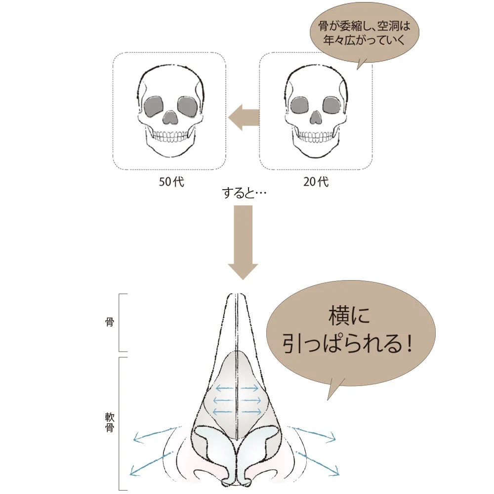 頭蓋骨崩れ」が、老け顔の原因!? « 宇山恵子 恵風ホームページ ～医療・健康・美容についてのコラム～