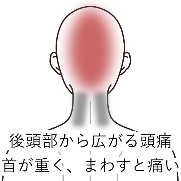 簡単に自分でつぼ押しできる！頭痛をともなう肩こり改善のツボ4選