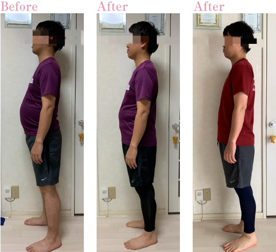 フォトフェイシャルは何回くらいで効果出る？継続するメリット、デメリットを解説します