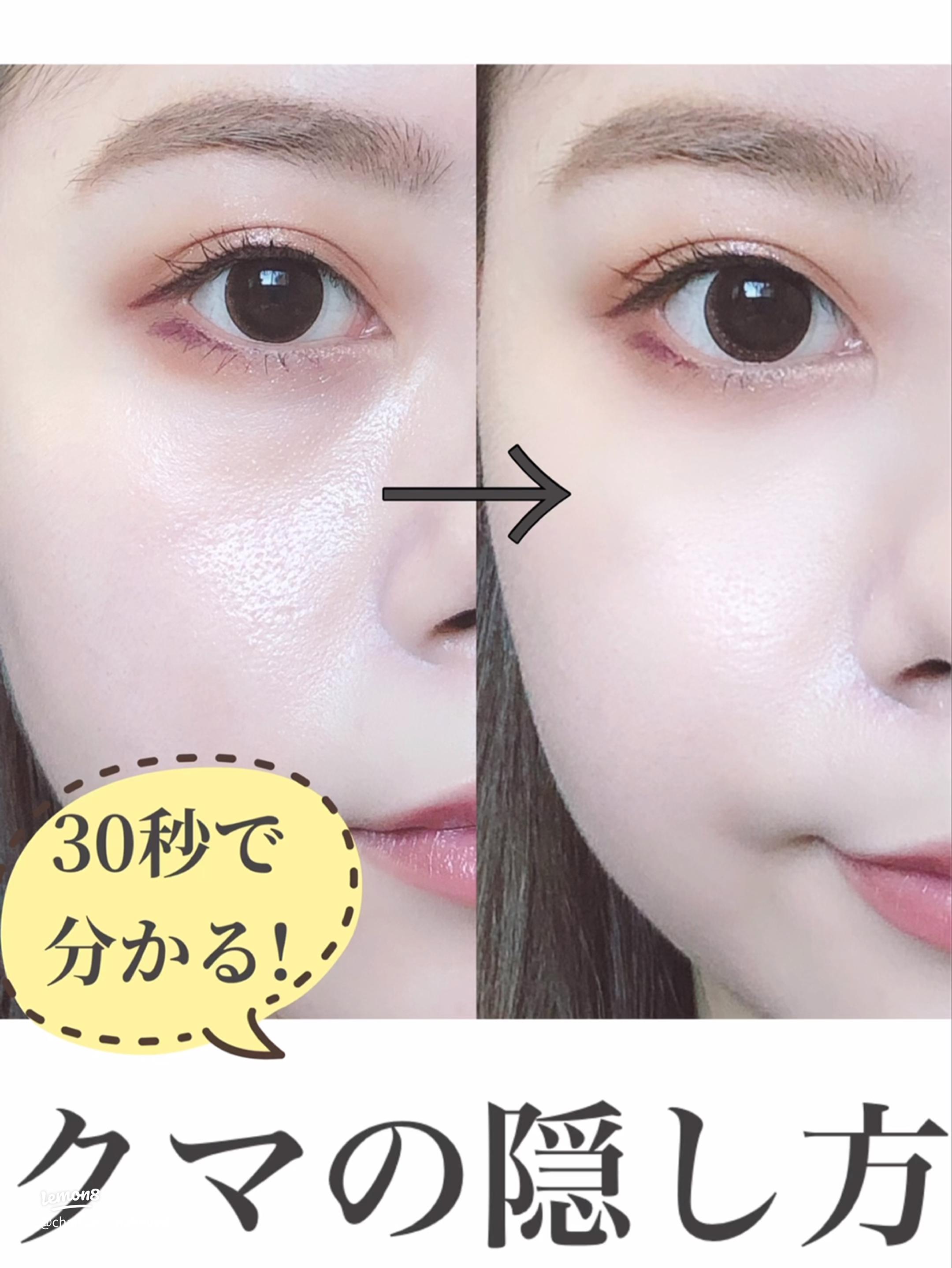 目の下クマ 疲れ 眠いイラスト無料イラスト・フリー素材なら「イラストAC」