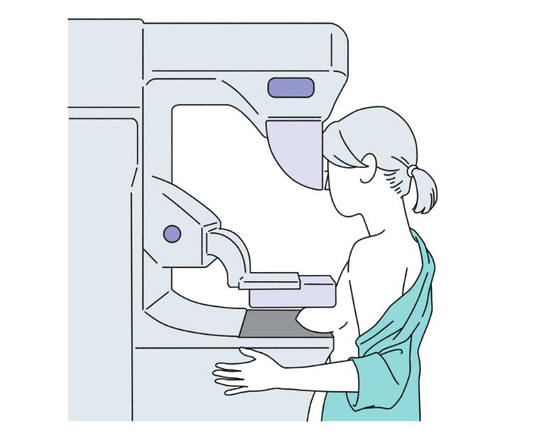 知っているようで知らない マンモグラフィーの基礎⑥ マンモグラフィーの弱点を補うために – Radiology@Home