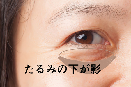目の下トレーニングで、たるみ・クマを解消✨, 目元の筋肉「眼輪筋」が弱くなると、, 目の下の脂肪が目立ちやすくなったり、,クマやたるみが気になりがちに 。, そんなお悩みには、この簡単トレーニング！👇, ① 目を細めるように下まぶたをキュッと持ち上げる, ②涙袋がぷっくりすればOK！, 毎日のケアで、すっきり目元を目指しましょう😊, 体験レッスン受付中！,