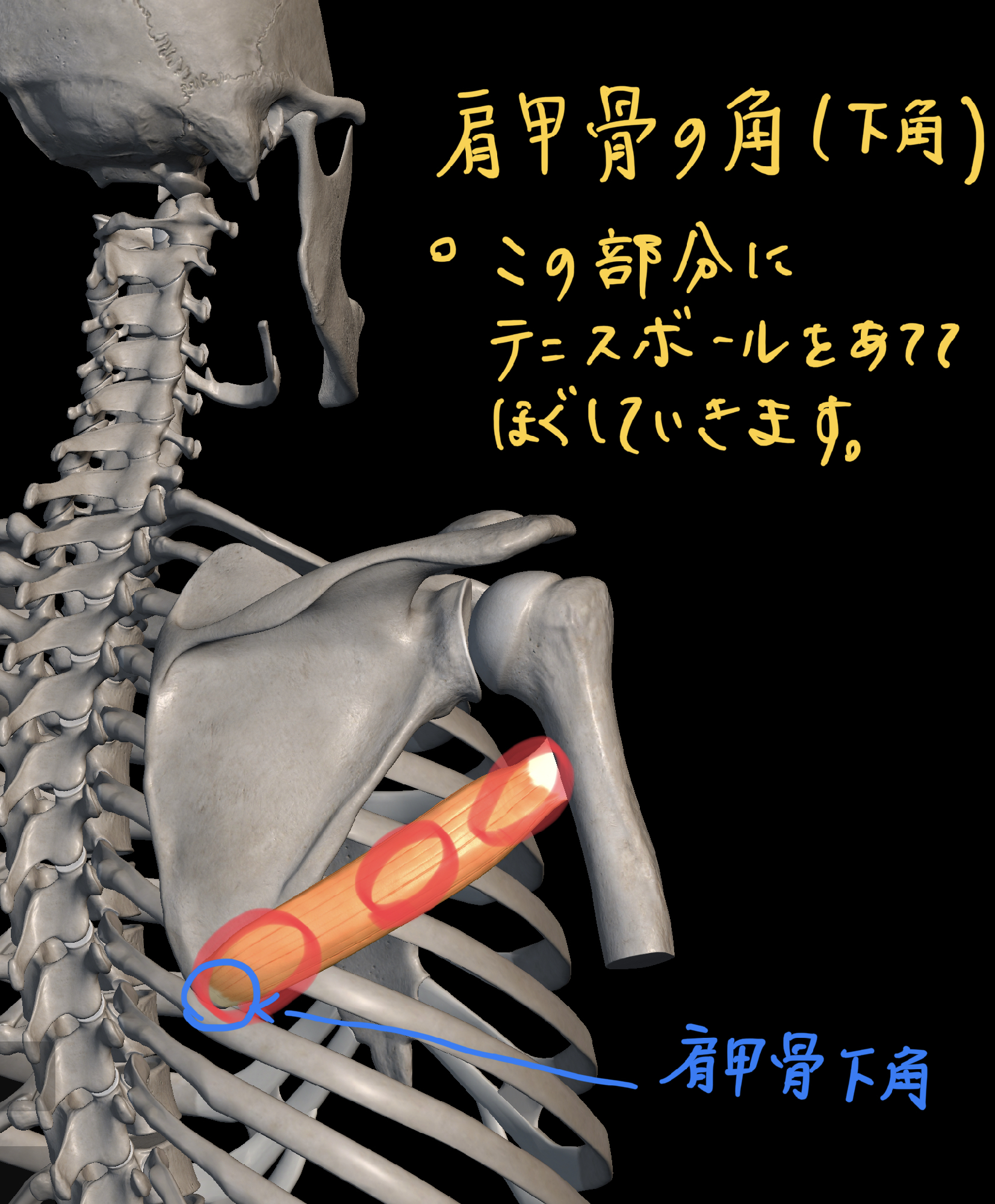 引っかかるような肩の痛み、その原因は？京都 北区 上京区 肩こり 腰痛 整体 外反母趾 野球肩整体ならもり鍼灸整骨院
