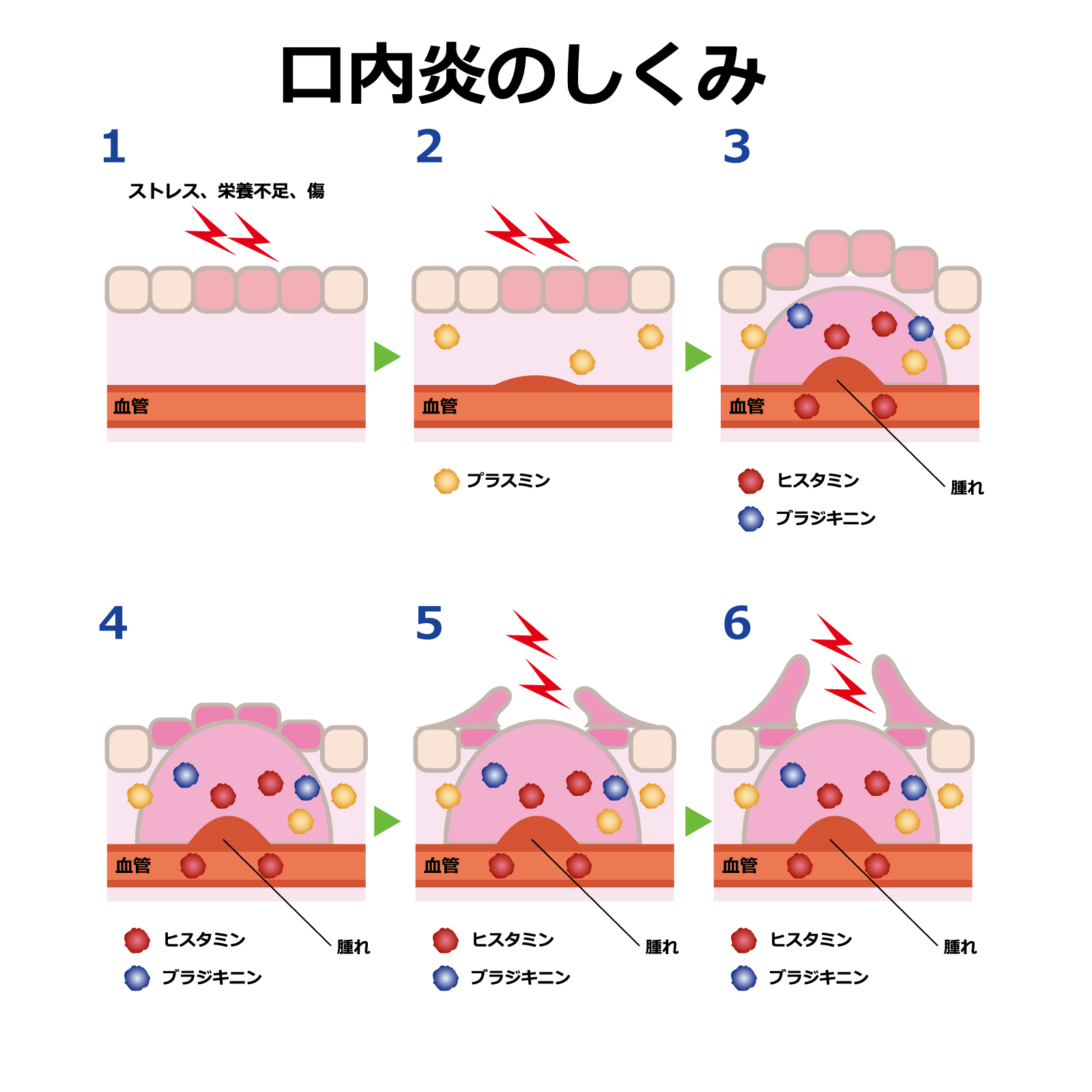 口内炎口腔外科東京銀座シンタニ歯科口腔外科クリニック
