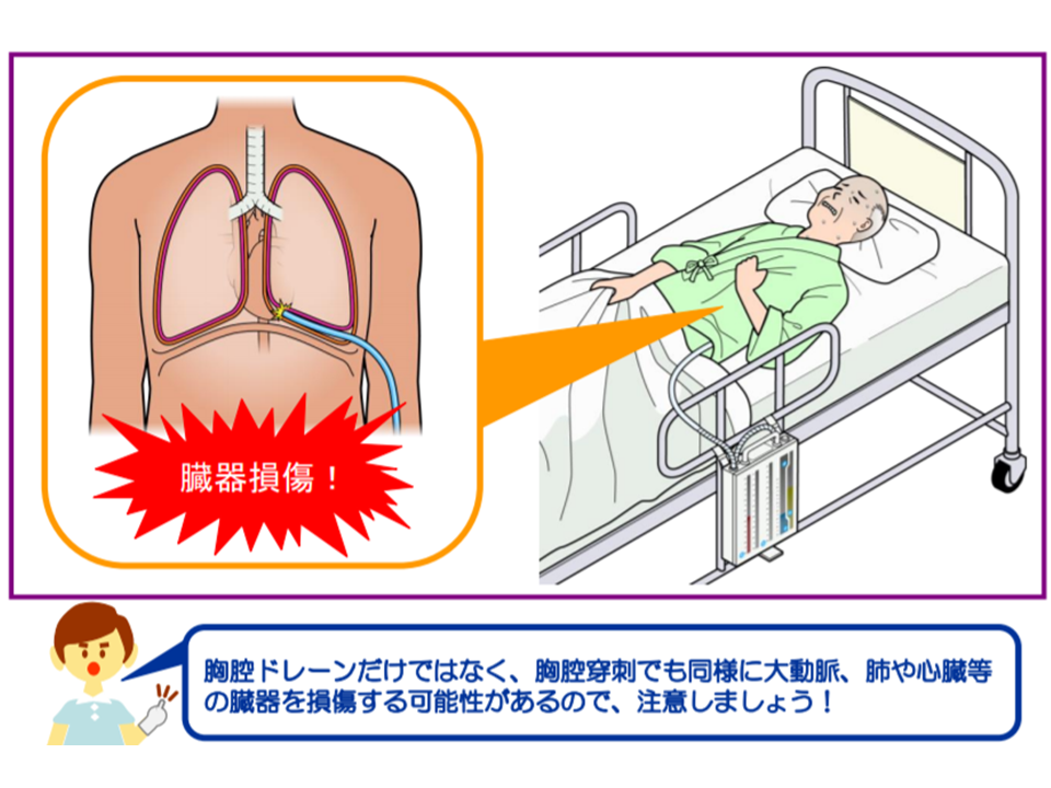 胸腔ドレナージ 胸膜までの深さを麻酔時に確認 2ページ目 ：Cadetto.jp