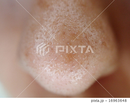 老廃物、角栓 など毛穴詰まりを大掃除！ プロの 毛穴ケア 徹底レポ ビューティニュース 美容メディアVOCE ヴォーチェ