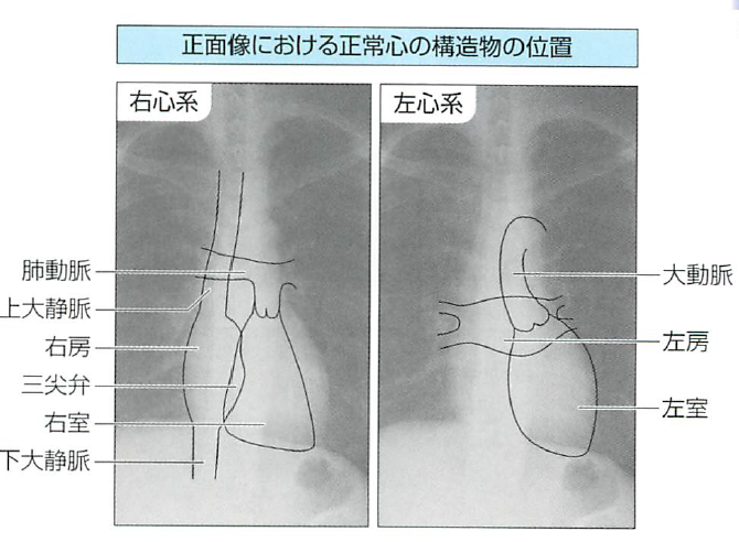 レントゲン 下半身TikTok