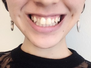 口を尖らせる là gì? Cách đọc, phiên âm & nghĩa của từ 口を尖らせる