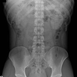 放射線 レントゲン・X線撮影 神戸垂水区やまがみ整形外科クリニック