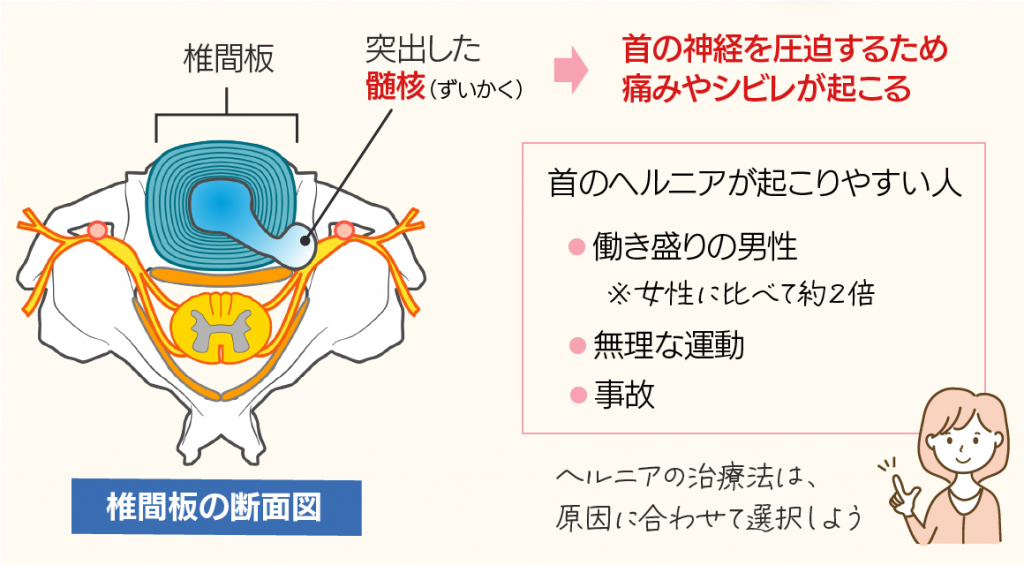 目からウロコの百人一首第3回 ３ あしひきの山鳥の尾のながながし夜をひとりかも寝むはんざわかんいち未草