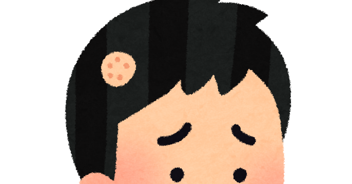 7,100点を超える薄毛のイラスト素材、ロイヤリティフリーのベクター素材グラフィックスとクリップアート - iStockハゲ, 薄毛 女性,抜け毛