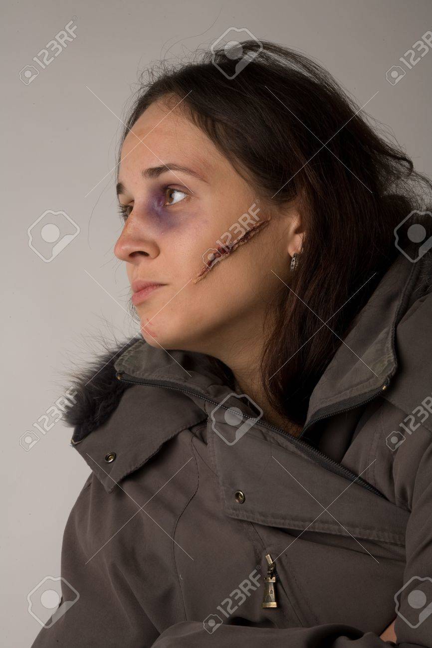 顔に傷のある女性キャラで好きなのは : r animequestions