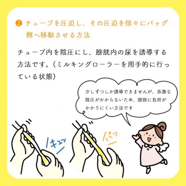 バルーンカテーテルの尿の捨て方は？尿廃棄の手順・方法や注意点を解説