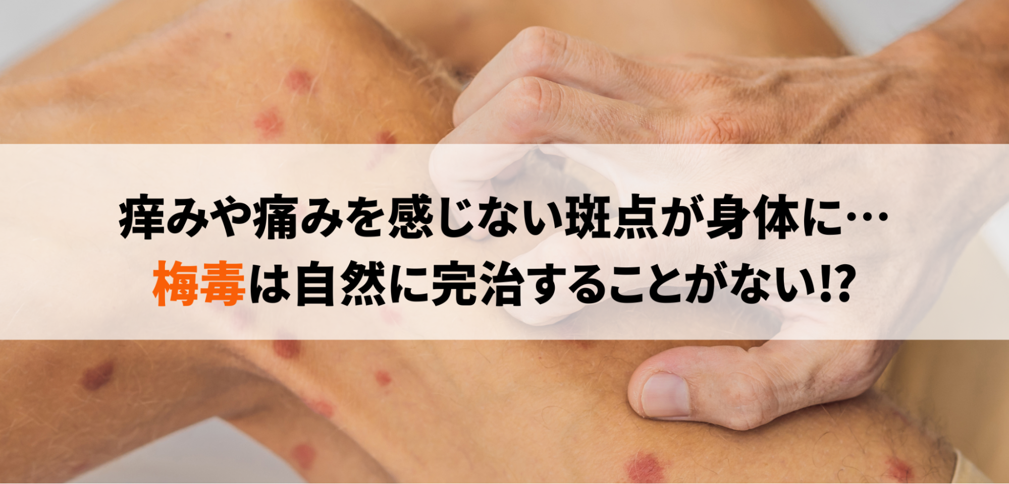 古くは“家康の次男”もかかり死亡 去年全国約1万3千人が感染『梅毒』の歴史 江戸時代は遊郭などで急増東海テレビNEWS