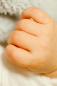 虫刺され ひどい目の腫れ。こんなになるなんて。治る過程、一部始終