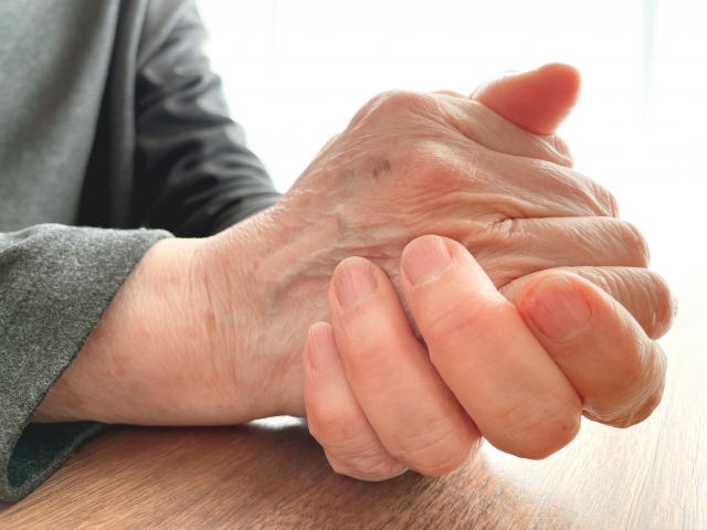 手のシミ治療 腕のシミ治療 – 南青山 皮膚科スキンソリューションクリニック青山通り