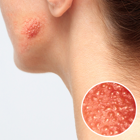 ホホバオイル無印良品の効果に関する口コミ - 毛穴の黒ずみは鼻が大きく見える🚨🚨🚨 by ゆたぬ🌨フォロバ◎ 混合肌 20代前半LIPS