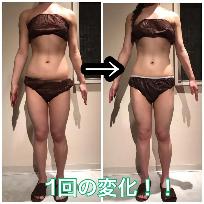 送料無料 ダイエット シール ワンダー ベリーパッチ 腹部用 5枚 肪燃焼 ダイエット 腹部 貼るだけ 無防腐剤 太もも セルライト 痩せの通販はauPAY マーケット - Michelle Noel au PAY マーケット店au PAY マーケット－通販サイト