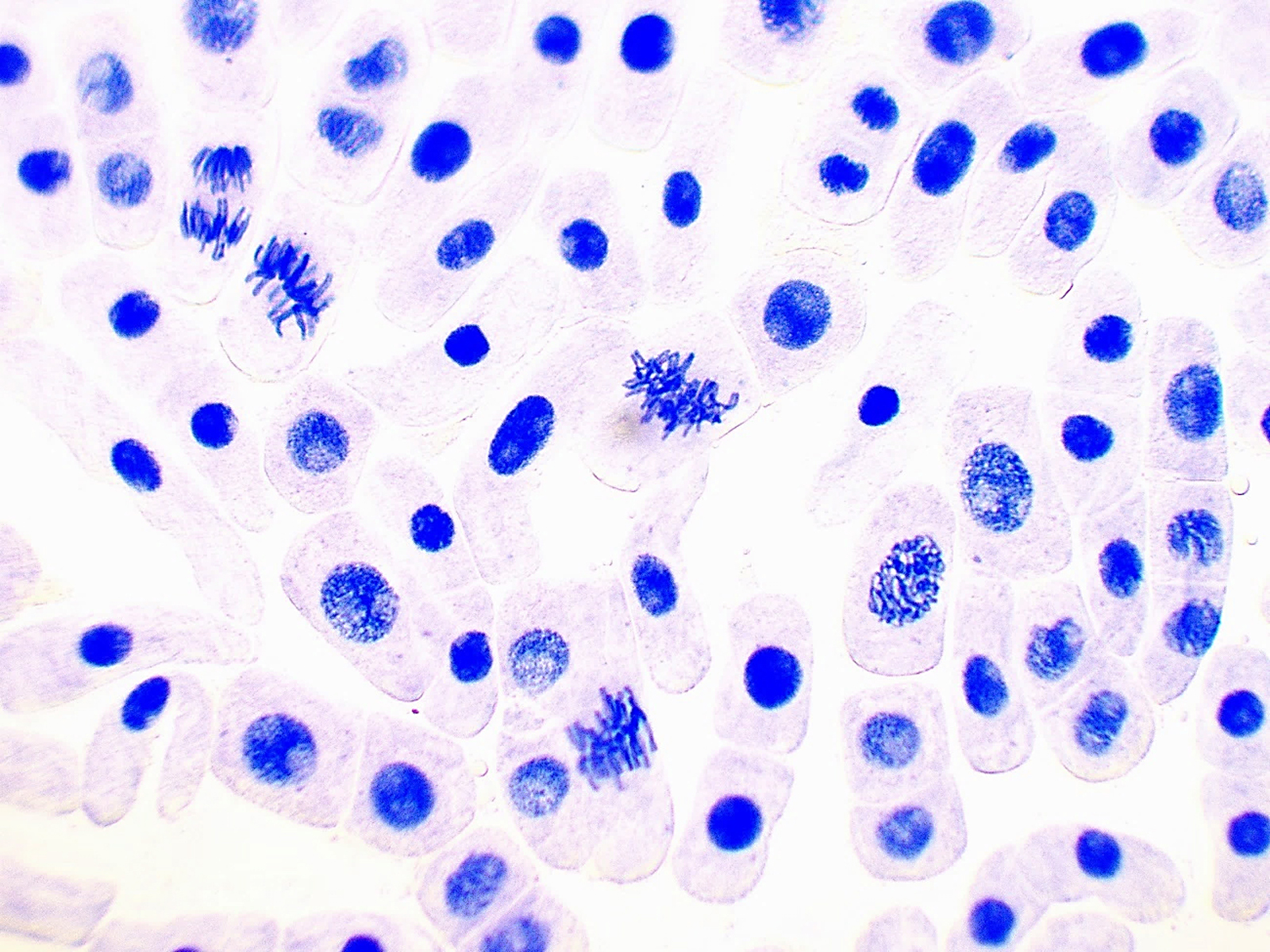 細胞分裂イラスト無料イラスト・フリー素材なら「イラストAC」