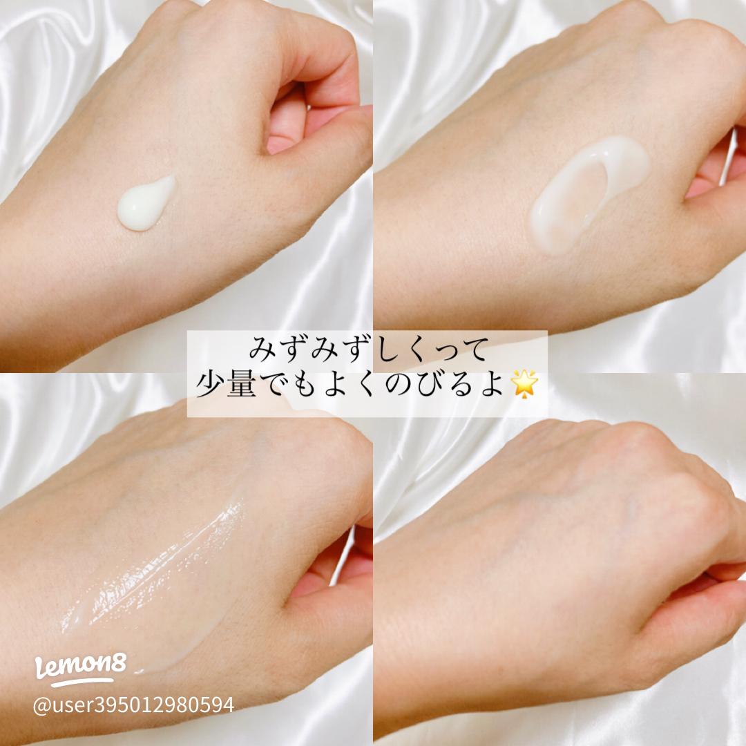 ニキビに効く？ フレイスラボ シカクリームの効果なしの口コミは本当？徹底検証EYLBEC エルベック