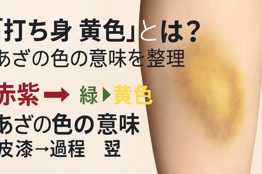 黄あざができる原因は？腕や胸・太ももに身に覚えのないできるあざの対処方法や病気の可能性を解説