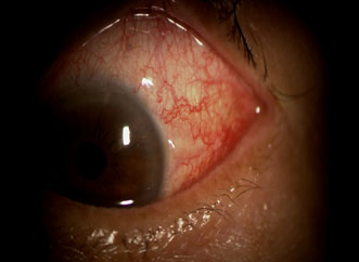 難読漢字 「血眼」って読めますか？「けつがん」ではありません 現代ビジネス編集部- 2ページ目現代ビジネス講談社