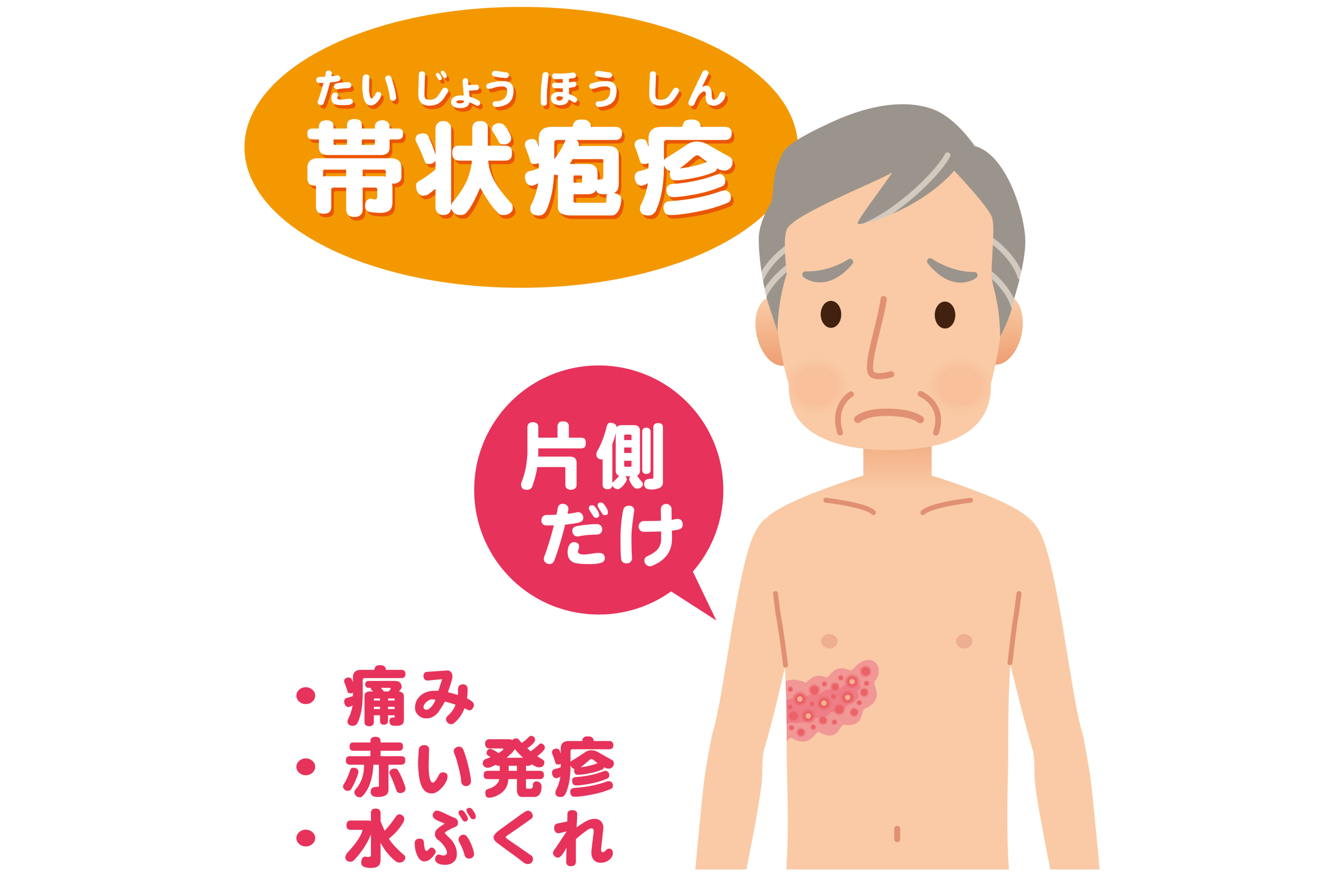 二度と嫌。痛いなんてもんじゃない」3人に1人が「帯状疱疹」に これからの季節は免疫力低下に要注意『every.特集』 日テレNEWS NNN-Yahoo!ニュース