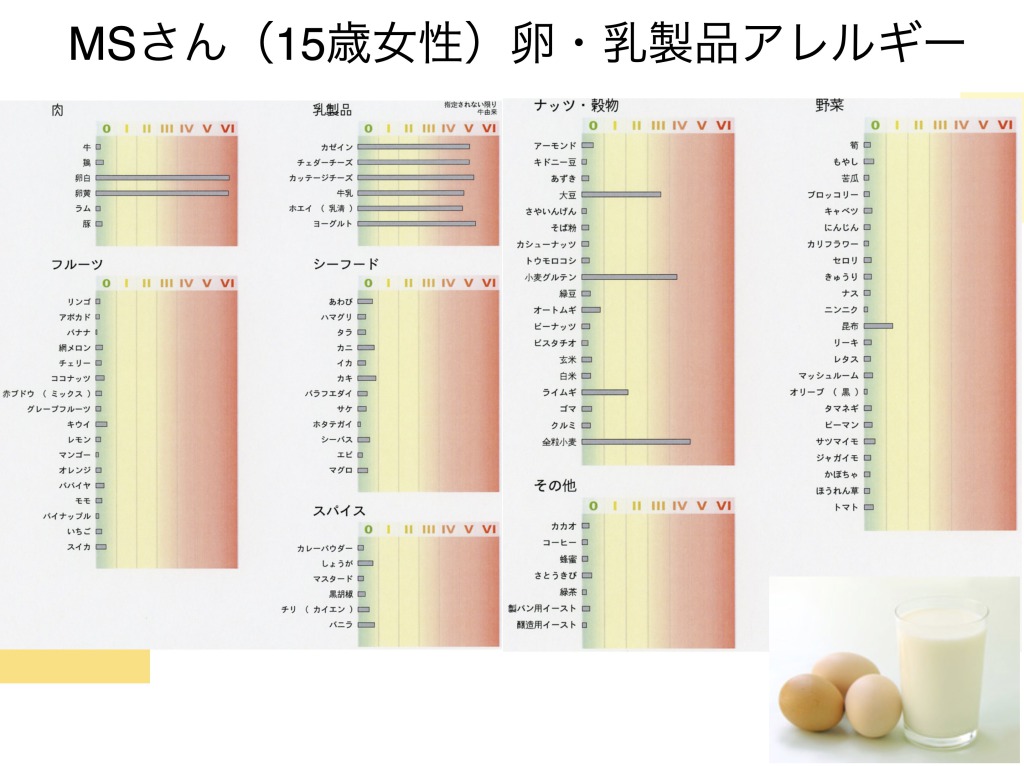 アレルギー検査のVIEW39とは？西新宿今野クリニック 内科 発熱外来 脳神経内科