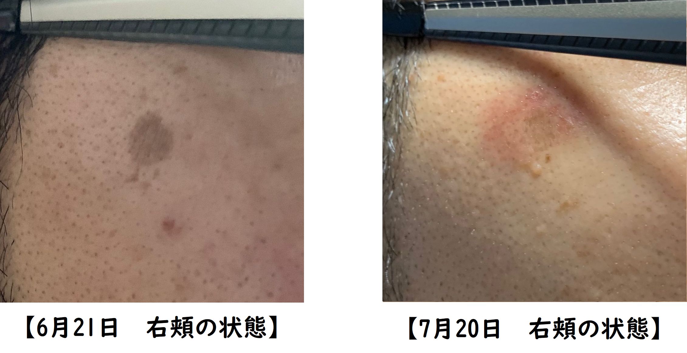 未使用に近いカソーダクリームイボホクロ日本製