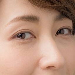 まぶたは加齢とともに痩せる？ 年を取ると二重になる理由 - 目元・クマ・眉下・涙袋整形の美容医療情報口コミ広場