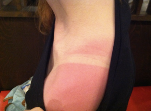 日焼け後のアフターケアは3ステップで！やってはいけない2選も - ラ ロッシュ ポゼ 公式