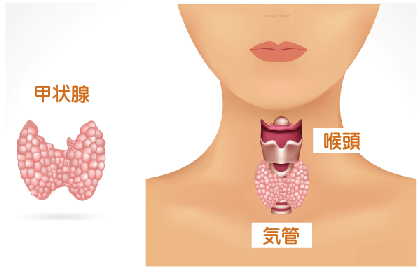 リンパ管腫についてリンパ管疾患情報ステーション