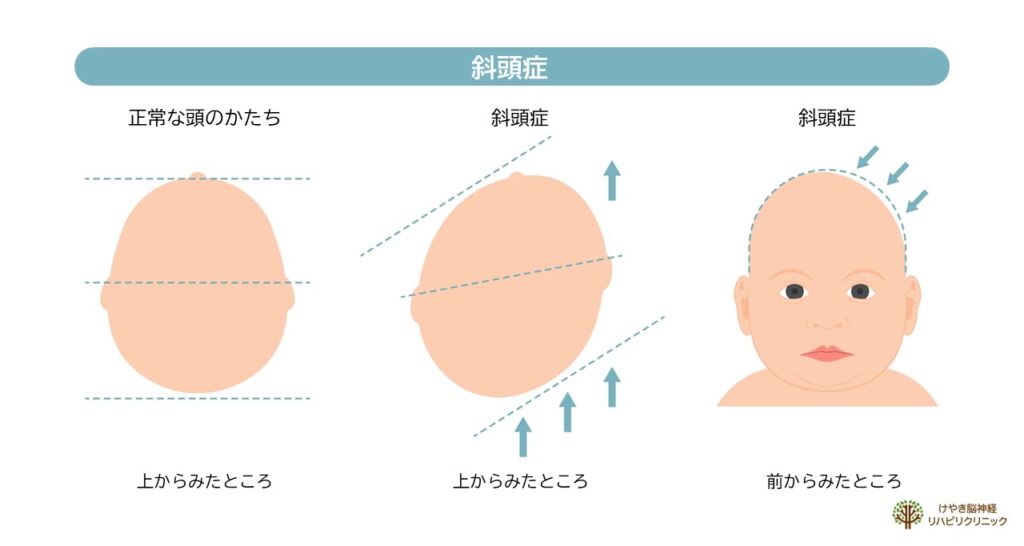 顔の老化に関係する顔面骨密度とは？「頭蓋骨トレ」で更年期老けを防ぐ – STORYストーリィオフィシャルサイト
