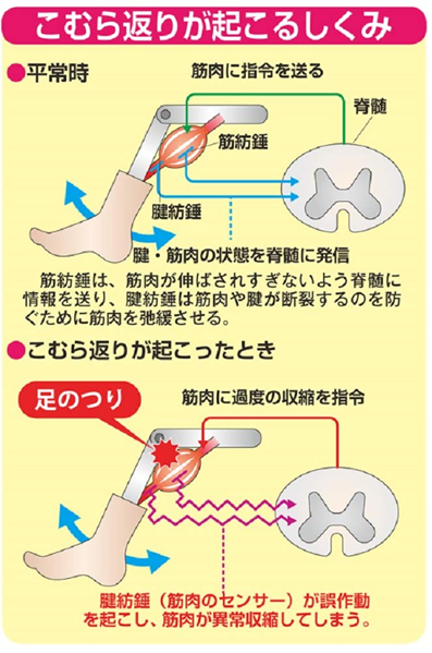 こむら返りの原因と対処法 筋肉のつりを予防する生活習慣を薬剤師が伝授！介護の教科書みんなの介護