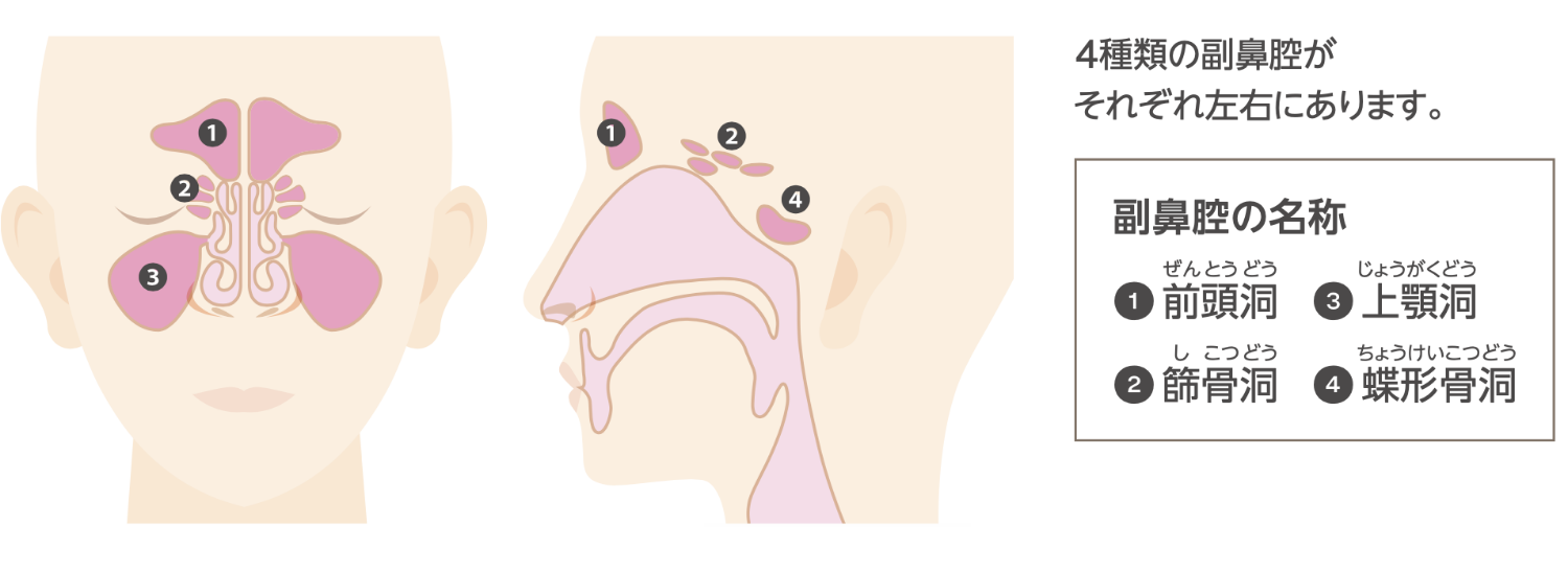 副鼻腔炎 蓄膿症 ・治りにくい慢性副鼻腔炎 好酸球性副鼻腔炎 の症状アレルギーi