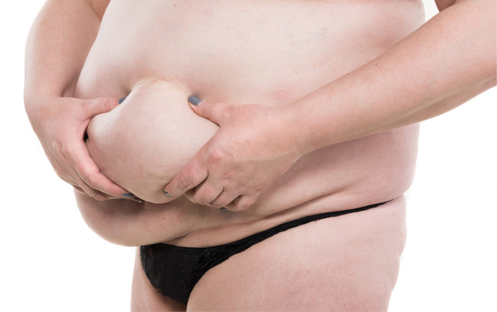 太った女性のお腹の写真素材FYI07531020ストックフォトの Qlean Market キュリンマーケット