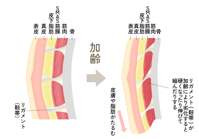 🟢頭蓋骨の老化による変化🟢Raplit