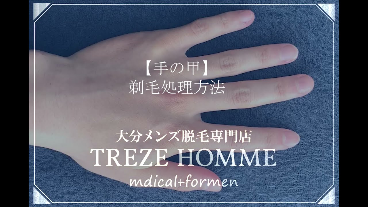 年齢が出やすい手の甲のシワを改善！手の甲のヒアルロン酸注入の処置前と5日後の症例です 50代女性美容整形クリニックA CLINIC 公式