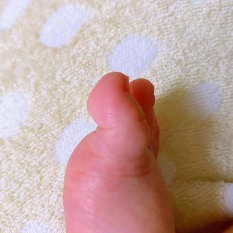 指の腹の写真素材写真素材なら「写真AC」無料 フリー ダウンロードOK