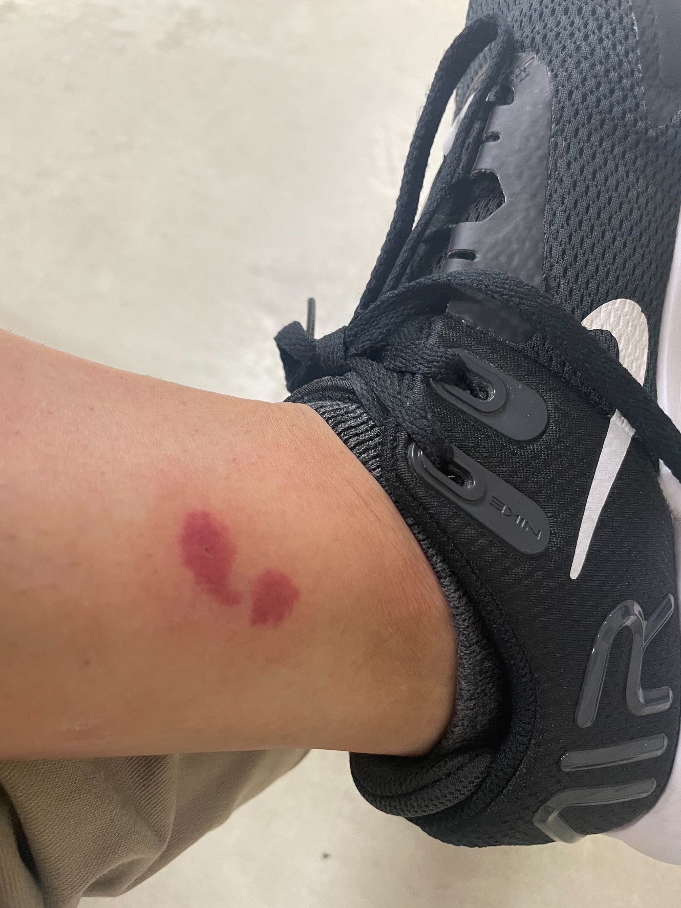 夏は「ブヨ」に注意！刺されたら？刺されないための対策は？小菅村総合情報サイト こ、こすげぇ