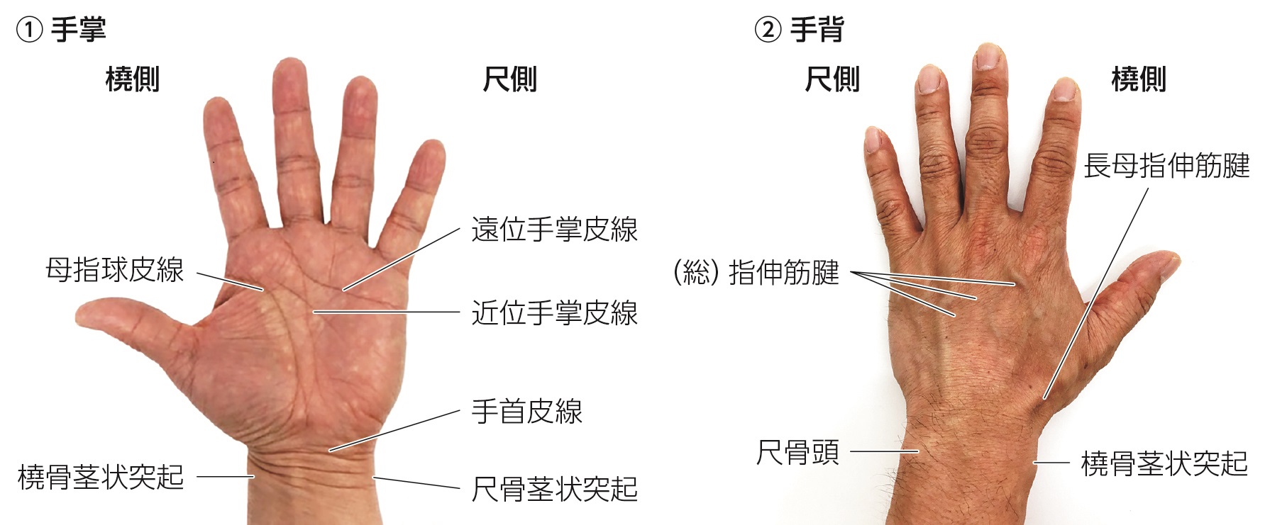 手や指の痛み間庭整形外科