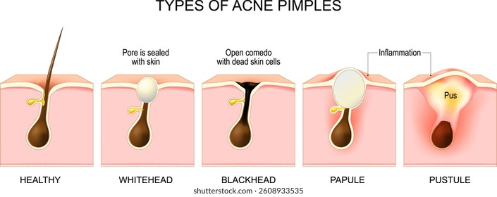 チャンネル史上最大級いや、地球史上最大級に腫れ上がった膿袋にレーザーで対抗する僕らの味方救世主歯医者かおり