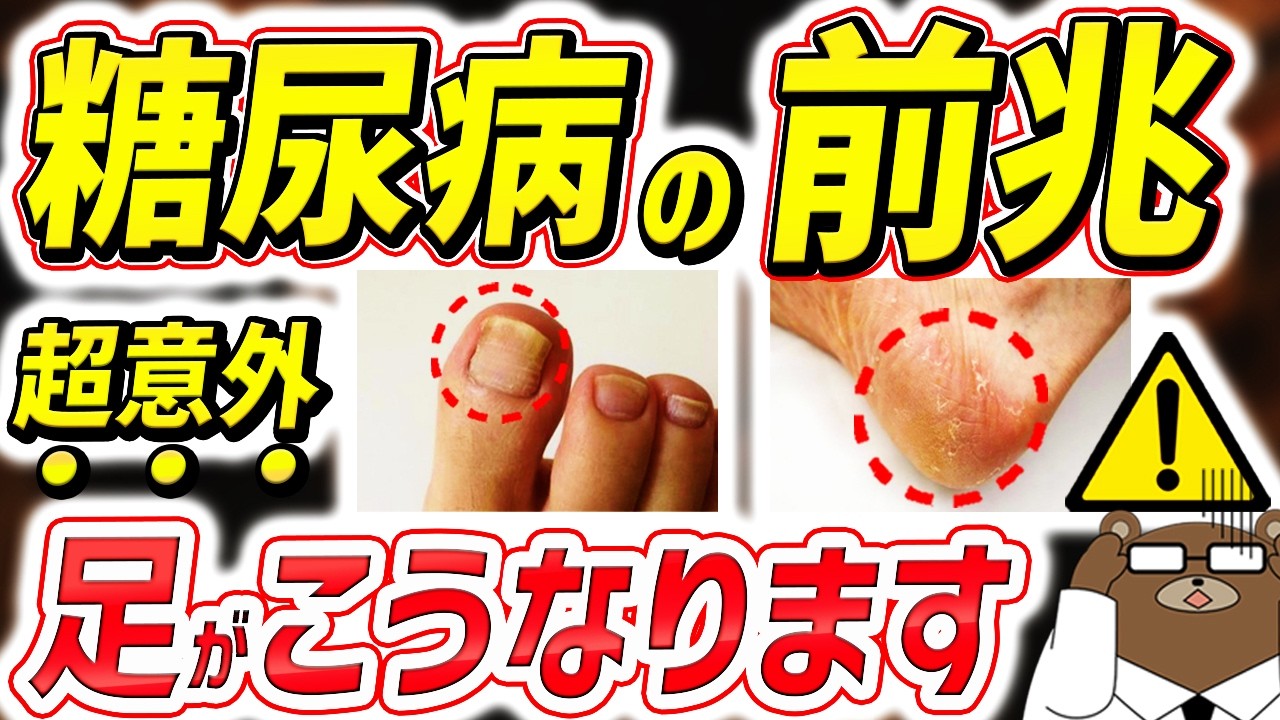 糖尿病とかゆみの関係は？皮膚に生じる主な症状や予防のポイントについて解説 - 府中すみよしクリニック