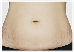 大人の蕁麻疹 じんましん 診察室でよくみる大人の病気 - みやけ内科・循環器科