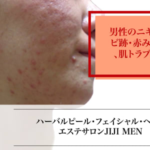 医師監修 メンズフェイシャルエステの選び方！おすすめのクリニック・サロン5選も紹介Midashinami 身だしなみ