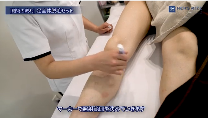 夏の腕脱毛・足脱毛を応援しております！お知らせ浜松市のメンズ脱毛・レディース脱毛・育毛サロン ロペス Lopez